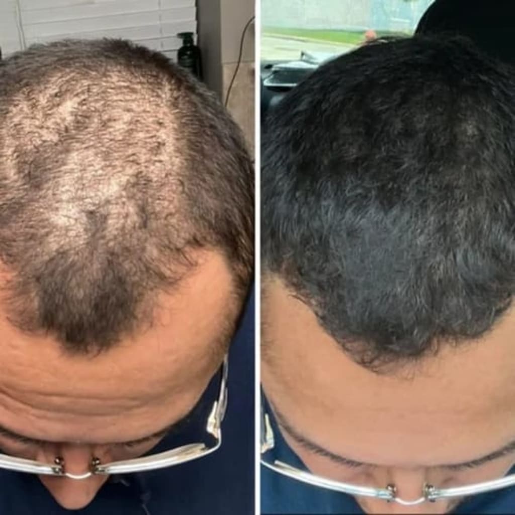 Reverse - Hair Growth Serum