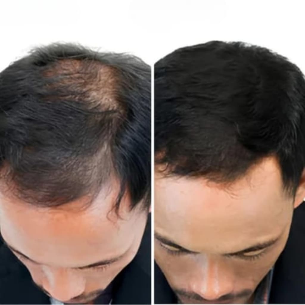 Reverse - Hair Growth Serum