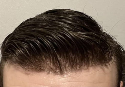 Reverse - Hair Growth Serum