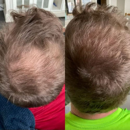 Reverse - Hair Growth Serum
