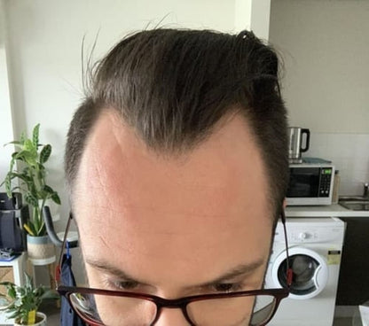 Reverse - Hair Growth Serum