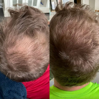 Reverse - Hair Growth Serum