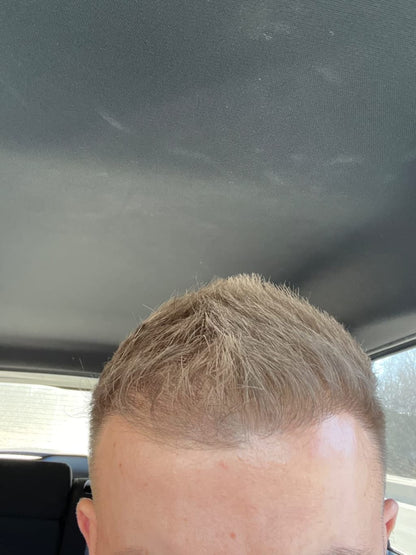 Reverse - Hair Growth Serum